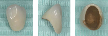 サンライズセラミック